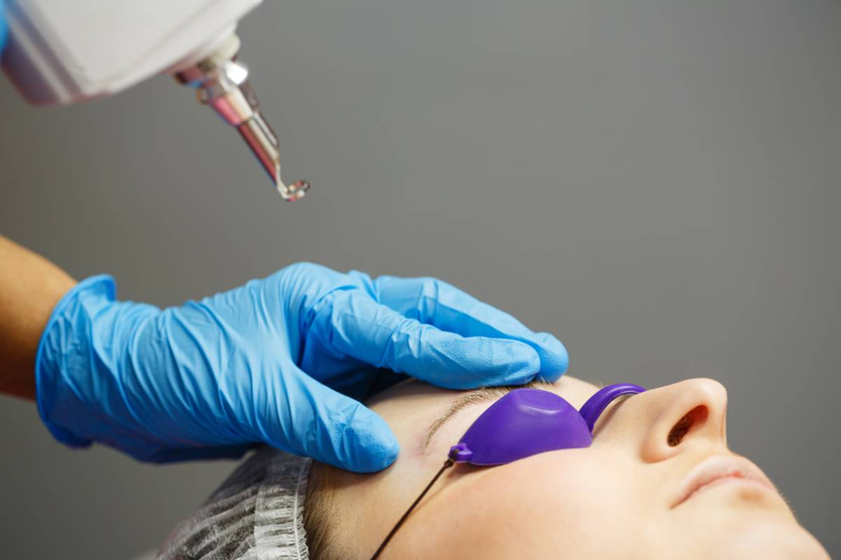 dr performing laser hair removal on face